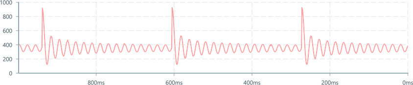 Screenshot of component LineChart basic